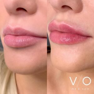 Med Spa near me in Clifton, NJ - VIO