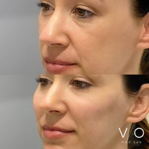 Med Spa near me in Clifton, NJ - VIO