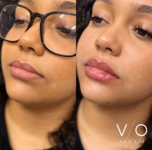 Med Spa near me in Clifton, NJ - VIO