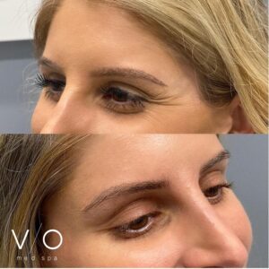 Med Spa near me in Clifton, NJ - VIO