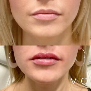 Med Spa near me in Clifton, NJ - VIO