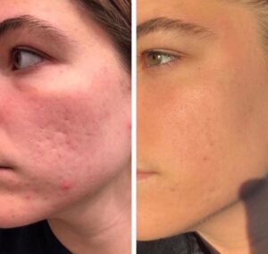 Med Spa near me in Clifton, NJ - VIO