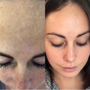 Med Spa near me in Clifton, NJ - VIO